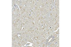 Immunohistochemistry of paraffin-embedded mouse spinal cord using IL11RA Rabbit mAb (ABIN7267984) at dilution of 1:150 (40x lens). (IL11RA Antikörper)