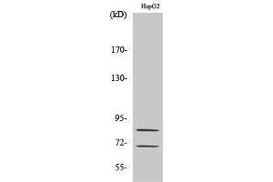Western Blotting (WB) image for anti-Choline O-Acetyltransferase (CHAT) (Internal Region) antibody (ABIN3183908) (Choline Acetyltransferase Antikörper  (Internal Region))