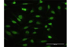 Immunofluorescence (IF) image for anti-Nuclear Factor of Activated T-Cells, Cytoplasmic, Calcineurin-Dependent 2 Interacting Protein (NFATC2IP) (AA 1-138) antibody (ABIN529820)