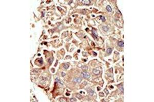 Image no. 2 for anti-Activin Receptor Type I (ACRV1) (Middle Region) antibody (ABIN360123)