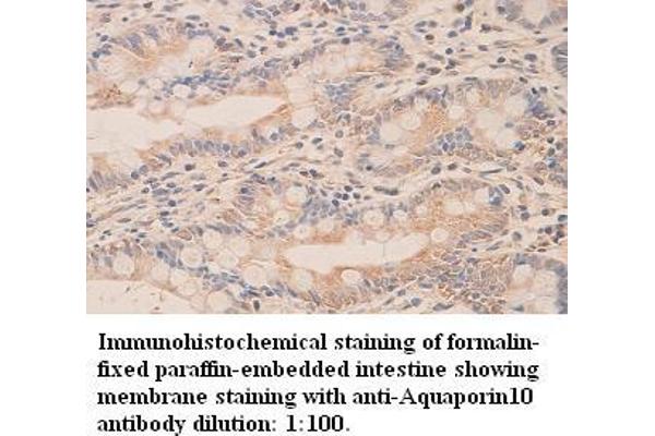 Aquaporin 10 Antikörper  (C-Term)