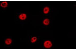ABIN6277199 staining HepG2 by IF/ICC. (Histone 3 Antikörper  (H3K27me2))