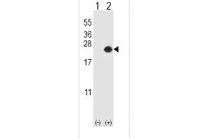 Western blot analysis of DUSP3 (arrow) using rabbit polyclonal DUSP3 Antibody (E6) (ABIN392924 and ABIN2842297). (Dual Specificity Phosphatase 3 (DUSP3) (AA 1-30), (N-Term) Antikörper)
