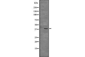 Western blot analysis of CCNY expression in Mouse bladder tissue lysate ;,The lane on the left is treated with the antigen-specific peptide. (Cyclin Y Antikörper  (Internal Region))