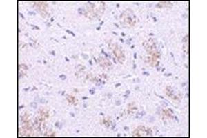 Immunohistochemistry of KLHL1 in rat brain tissue with this product at 10 μg/ml.