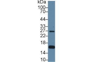 Detection of AQP2 in Human Hela cell lysate using Polyclonal Antibody to Aquaporin 2, Collecting Duct (AQP2) (AQP2 Antikörper  (AA 177-271))