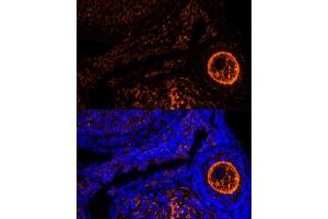 Immunofluorescence analysis of mouse oophoroma cells using ZP2 antibody (ABIN6128965, ABIN6150534, ABIN6150535 and ABIN6214263) at dilution of 1:100. (ZP2 Antikörper  (AA 651-745))