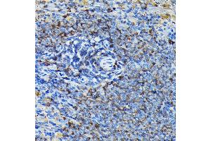 Immunohistochemistry of paraffin-embedded mouse spleen using RPL23A Rabbit pAb (ABIN1682576, ABIN3018519, ABIN3018520 and ABIN6220494) at dilution of 1:100 (40x lens). (RPL23A Antikörper  (AA 1-156))