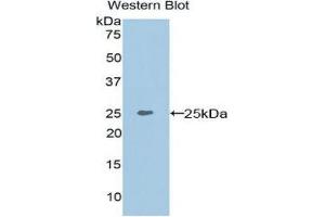 Western Blotting (WB) image for anti-Matrix Extracellular phosphoglycoprotein (MEPE) (AA 28-224) antibody (ABIN1859803)