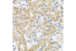 Immunohistochemistry of paraffin-embedded mouse kidney using CCDC124 antibody  at dilution of 1:100 (40x lens). (CCDC124 Antikörper  (AA 1-223))