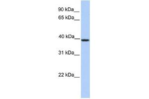 Western Blotting (WB) image for anti-serpin Peptidase Inhibitor, Clade A (Alpha-1 Antiproteinase, Antitrypsin), Member 5 (SERPINA5) (C-Term) antibody (ABIN2785441)