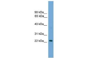 WB Suggested Anti-RAB39 Antibody Titration: 0. (RAB39 Antikörper  (N-Term))