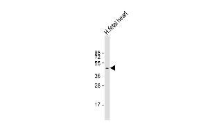 Anti-ZDHHC18 Antibody (C-Term) at 1:1000 dilution + human fetal heart lysate Lysates/proteins at 20 μg per lane. (ZDHHC18 Antikörper  (AA 331-361))