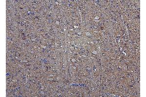 IHC analysis of Hexokinase 1/HK1 using anti-Hexokinase 1/HK1 antibody (ABIN7600260). (Hexokinase 1 Antikörper  (AA 17-323))