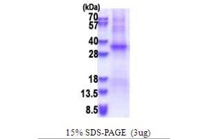 SDS-PAGE (SDS) image for Testis-Specific Serine Kinase 6 (TSSK6) (AA 1-273) protein (His tag) (ABIN5853645)