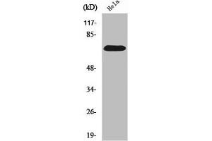 Western Blot analysis of HepG2 cells using SDHA Polyclonal Antibody (SDHA Antikörper  (C-Term))