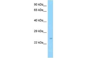 WB Suggested Anti-Slc9a3r2 Antibody Titration: 1. (SLC9A3R2 Antikörper  (C-Term))