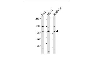 All lanes : Anti-VAV2 Antibody (N-Term) at 1:2000 dilution Lane 1: Hela whole cell lysate Lane 2: MCF-7 whole cell lysate Lane 3: SH-SY5Y whole cell lysate Lysates/proteins at 20 μg per lane. (VAV2 Antikörper)