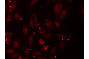 Immunofluorescence analysis of U2OS cells using PCCB antibody (ABIN5973142). (PCCB Antikörper)
