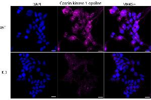 Immunocytochemical staining of HeLa cells using Casein kinase 1 epsilon antibody (ABIN7797881), 1:1,000), Top panel: wild-type (WT), Bottom panal: Casein kinase 1 epsilon shRNA knockdown (KD). (CK1 epsilon Antikörper)