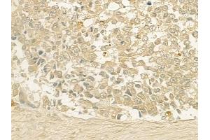 ABIN6257620 and ABIN6275306 at 1/100 staining human normal gastric tissue by IHC-P. (NEGR1 Antikörper  (Internal Region))