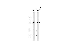 All lanes : Anti-TIGD1 Antibody (N-term) at 1:1000 dilution Lane 1: Hela whole cell lysate Lane 2: MCF-7 whole cell lysate Lysates/proteins at 20 μg per lane. (TIGD1 Antikörper  (N-Term))