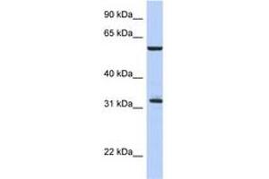 Image no. 1 for anti-Cell Division Cycle 34 (CDC34) (C-Term) antibody (ABIN6744356)