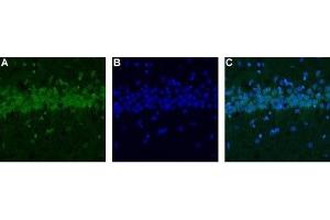 Expression of CALHM1 in rat hippocampus - Immunohistochemical staining of rat hippocampus using Anti-CALHM1 Antibody (ABIN7043013, ABIN7044044 and ABIN7044045). (CALHM1 Antikörper  (Intracellular))
