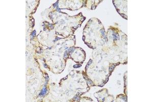 Immunohistochemistry of paraffin-embedded human placenta using ECH1 antibody  at dilution of 1:150 (40x lens). (ECH1 Antikörper  (AA 1-328))