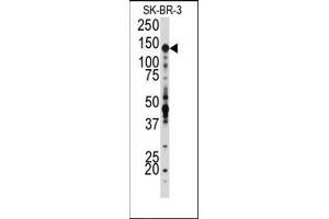 Western blot analysis of anti-IGF1R Antibody (N-term) in SK-BR-3 cell line lysates (35ug/lane). (IGF1R Antikörper  (N-Term))