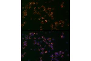 Immunofluorescence analysis of Jurkat cells using CD99 Rabbit pAb (ABIN3022730, ABIN3022731, ABIN3022732, ABIN1512728 and ABIN6219199) at dilution of 1:25 (40x lens).