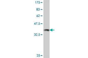 Western Blot detection against Immunogen (35. (CFDP1 Antikörper  (AA 168-251))