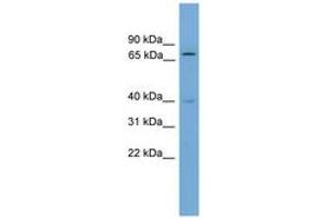 Image no. 1 for anti-Multiple Endocrine Neoplasia 1 (MEN1) (AA 351-400) antibody (ABIN6744537) (Menin Antikörper  (AA 351-400))