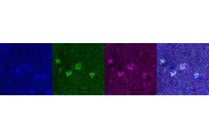 Immunohistochemistry (IHC) image for anti-Oligodendrocyte Lineage Transcription Factor 2 (OLIG2) antibody (ABIN7456327) (OLIG2 Antikörper)