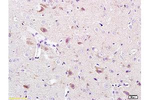 Formalin-fixed and paraffin-embedded rat brain labeled with Anti-CACNA1G/Cav3.
