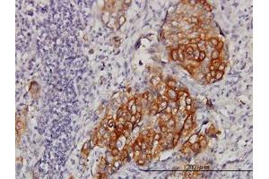Image no. 1 for anti-Eukaryotic Translation Initiation Factor 4 gamma 3 (EIF4G3) (AA 1-516) antibody (ABIN599054) (EIF4G3 Antikörper  (AA 1-516))