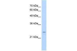 WB Suggested Anti-IER2 Antibody Titration:  0. (IER2 Antikörper  (N-Term))