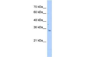 WB Suggested Anti-MRPS15 Antibody Titration: 0. (MRPS15 Antikörper  (N-Term))