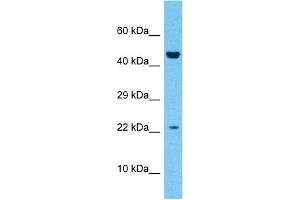 Host:  Rabbit  Target Name:  ZN576  Sample Type:  Fetal Liver lysates  Antibody Dilution:  1ug/ml (ZNF576 Antikörper  (Middle Region))