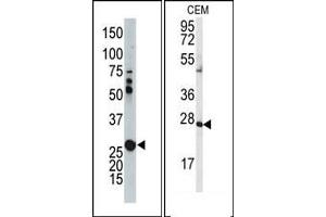 Image no. 1 for anti-Adenylate Kinase 2 (AK2) (N-Term) antibody (ABIN360624) (Adenylate Kinase 2 Antikörper  (N-Term))