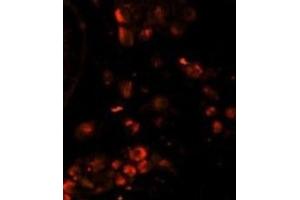 Immunofluorescence (IF) image for anti-Lin-28 Homolog A (C. Elegans) (LIN28A) antibody (ABIN2995304)