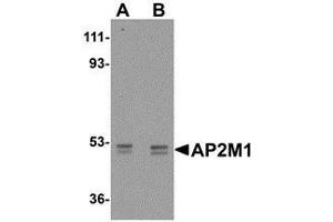 Western blot analysis of AP2M1 in human kidney tissue lysate with AP30054PU-N AP2M1 antibody at (A) 1 and (B) 2 μg/ml.