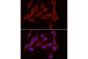 Immunofluorescence (IF) image for anti-Solute Carrier Family 7, (Cationic Amino Acid Transporter, Y+ System) Member 11 (SLC7A11) (AA 150-250) antibody (ABIN6148046)
