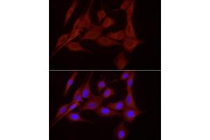 Immunofluorescence analysis of NIH/3T3 cells using SLC7/xCT Rabbit pAb (ABIN6134319, ABIN6148046, ABIN6148047 and ABIN6217771) at dilution of 1:200 (40x lens). (SLC7A11 Antikörper  (AA 150-250))