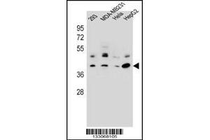 Western blot analysis in 293,MDA-MB231,Hela,HepG2 cell line lysates (35ug/lane). (GTR2 Antikörper  (AA 169-198))