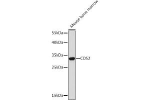 Western blot analysis of extracts of Mouse bone marrow, using CD52 Rabbit pAb (ABIN7266207) at 1:300 dilution. (CD52 Antikörper  (AA 1-61))