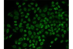 Immunofluorescence analysis of MCF-7 cells using RL2 antibody (ABIN6132938, ABIN6146651, ABIN6146653 and ABIN6217641). (ARIP4 Antikörper  (AA 1178-1467))