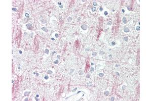 Anti-GPR125 antibody IHC staining of human brain, cortex. (GPR125 Antikörper  (AA 1098-1109))