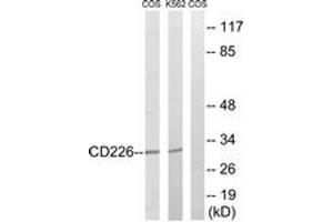 Western blot analysis of extracts from COS7/K562 cells, treated with PMA 125ng/ml 30' , using CD226/DNAM-1 (Ab-329) Antibody. (CD226 Antikörper  (AA 287-336))