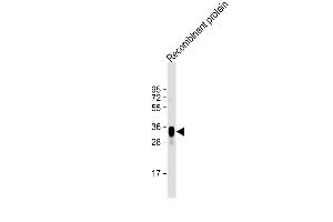 Anti-LRP1B Antibody at 1:2000 dilution + Recombinant protein Lysates/proteins at 20 μg per lane. (LRP1B Antikörper)